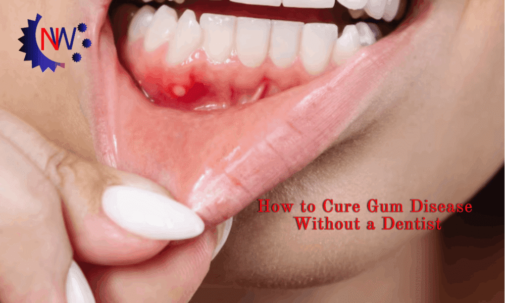 How to Cure Gum Disease Without a Dentist